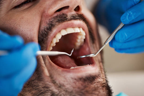 Best Emergency Treatment for Dental Infections or Abscesses in Lmdale, PA